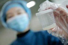 无精的症状是什么